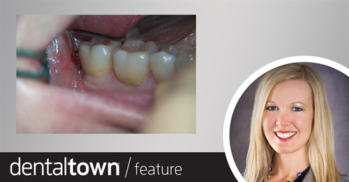 Shades of Gray Dr. Rachel A. Schallhorn explains why periodontal disease classification, despite its many improvements, can still be quite difficult, and shares three unique cases detailing how to navigate these steps successfully. 