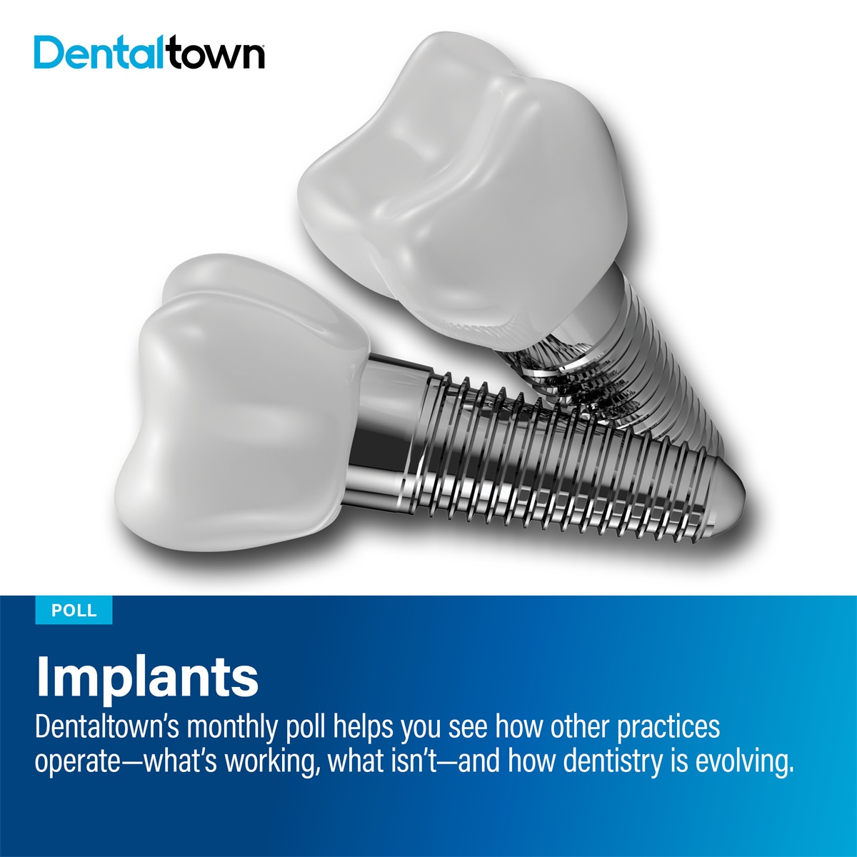 Poll: Implants