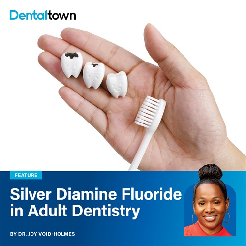 Silver Diamine Fluoride in Adult Dentistry Dr. Joy Void-Holmes examines the growing evidence behind silver diamine fluoride as a minimally invasive option for managing deep caries in adult patients.
