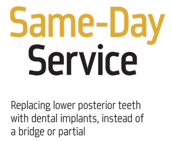 Show your work: Same-Day Service Dr. Ara Nazarian shares a case study involving same-day implants for four teeth in the lower posterior region.