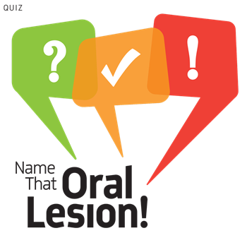 Name that Oral Lesion! Dr. Seena Patel’s shares several images from case studies and challenges readers to identify what the radiographs reveal.