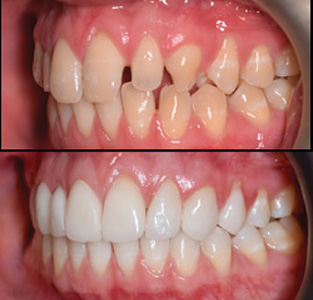Show Your Work: A Combined Digital Orthodontic and Restorative Approach 