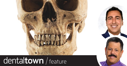 Building the ridge with a Bone Plate Drs. Arun Garg and Gregori Kurtzman discuss augmenting a lateral ridge by using a decalcified cortical bone plate for implant site preparation.