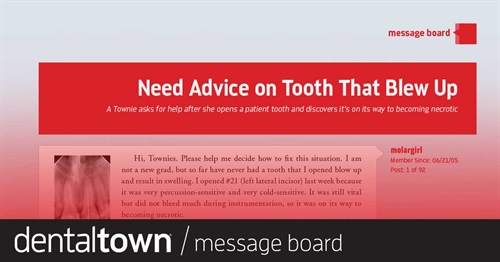 Need Advice on Tooth That Blew Up This Townie opened a patient’s tooth because it was sensitive to percussion and cold, and discovered it was on its way to becoming necrotic. What should she do?