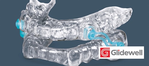 Product Profile: Silent Nite Sleep Appliance Dental solution for treating sleep-disordered breathing from Glidewell