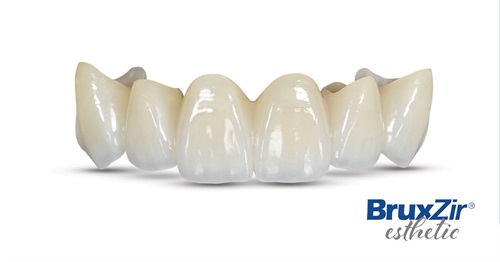 Product Profile: BruxZir Esthetic Zirconia Created for the anterior smile zone