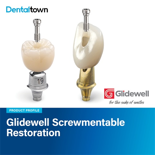 Product Profile: Glidewell Screwmentable Restoration Simplify implant delivery while elevating clinical and aesthetic outcomes.