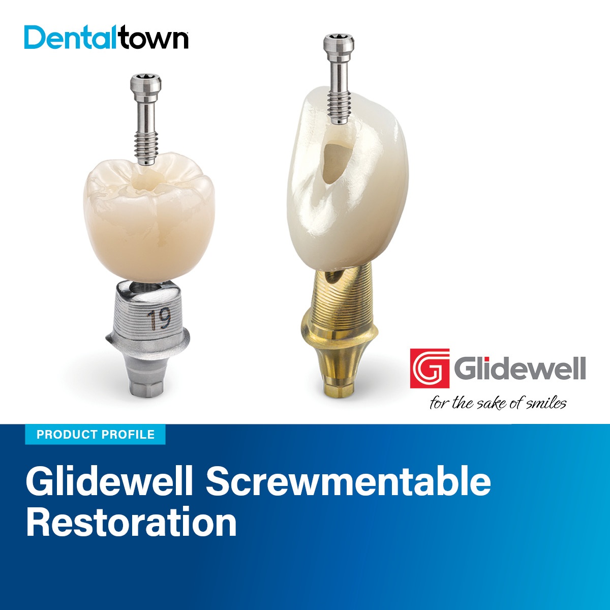 Product Profile: Glidewell Screwmentable Restoration
