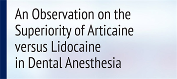 Continuing Education: An Observation on the Superiority of Articaine versus Lidocaine in Dental ... In this in-depth course, authors Fabio Velotti, Bernardo Verrengia and Deborah Laird compare and contrast articaine 4 percent and lidocaine 2 percent.