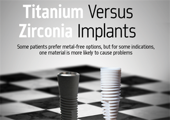 Titanium Versus  Zirconia Implants Dr. Saurabh Gupta explains certain factors that should help clinicians determine which implant material is preferred for a case.