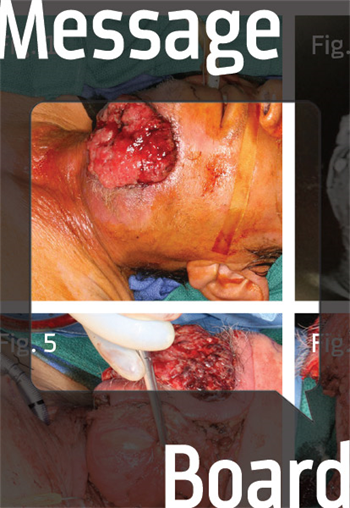 Christmas Cancer An oral surgeon shares a case that illustrates the importance of performing thorough checks for head and neck cancer.
