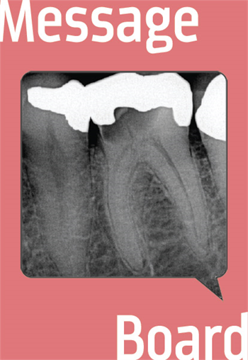 I’m Getting  Myself Hyped Up About an Ext. A Townie looks for tips on a molar extraction.