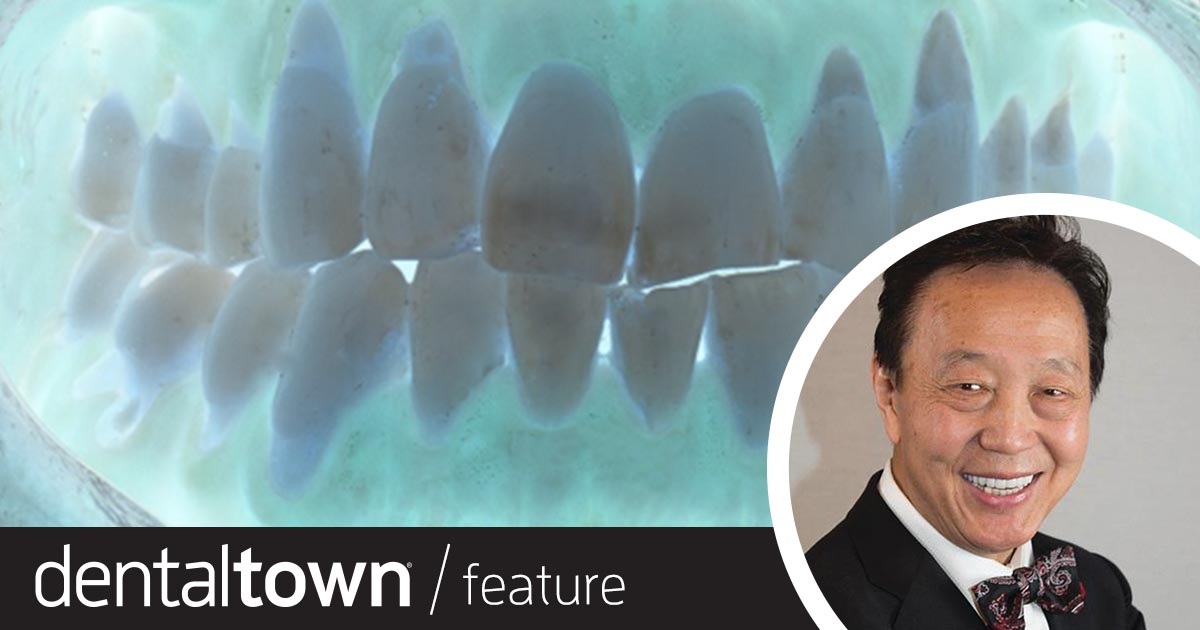 Our Roots Are(n’t) Showing Dr. John Chao shares a case study that demonstrates the minimally invasive Pinhole Surgical Technique in reversing gingival recession.