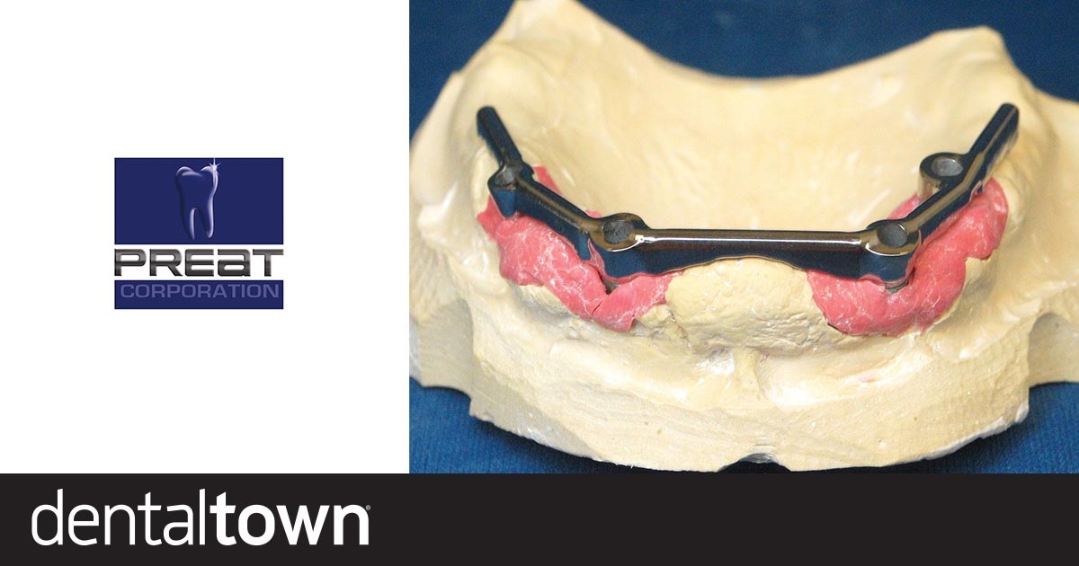 Product Profile: Hader Bar Attachment System A versatile overdenture system