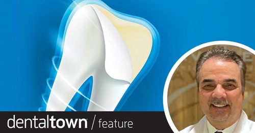 Direct Composite Veneers Dr. David Eshom demonstrates how to create direct composite veneers that are stronger and more stain-resistant than conventional placement of composite.