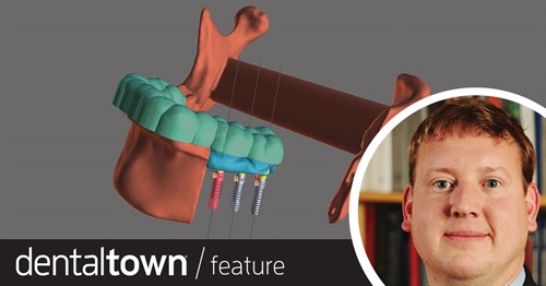 3D Printing for Total Jaw Reconstruction Townie oral surgeon Dr. Fayette Williams shares a case where, thanks to digital planning and 3D printing technology, he created a provisional prosthesis within 24 hours, allowing malignant disease to be restored with immediate teeth.