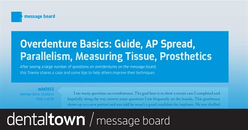 Overdenture Basics: Guide, AP Spread, Parallelism, Measuring Tissue, Prosthetics After seeing a large number of questions on overdentures on the message board, this Townie shares a case and some tips to help others improve their techniques