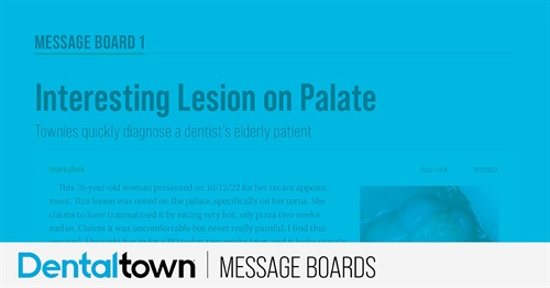 Interesting Lesion on Palate Townies quickly diagnose a dentist’s elderly patient.