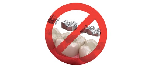 Howard Speaks: Should Amalgam Be Banned in the U.S.? With the EU set to ban dental amalgam over environmental concerns, will the U.S. follow? Dentaltown founder Dr. Howard Farran explores the debate, its impact and the future of amalgam in dentistry. 