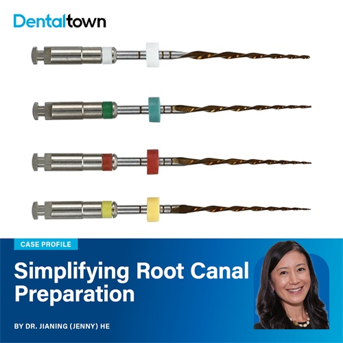 Case Profile: Simplifying Root Canal Preparation Dr. Jianing (Jenny) He walks through a simpler approach to root canal preparation using EdgeOne Blaze Utopia.