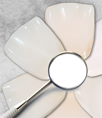 CE: Material Classification and Shade Selection Protocol for All-Ceramic Restorations Dr. Arthur R. Volker shares his expertise on shade  matching and lab communication using several different ceramic systems.