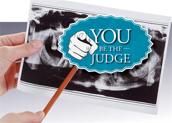 You Be the Judge: The Case of the Lazy X-Rays Jeffrey J. Tonner, JD, examines a malpractice and shares the details. How would you have ruled on this case?