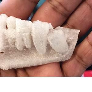 3-D Printing DentaltownUK editor Mike Gow talks with Raj Nath about 3D printing
