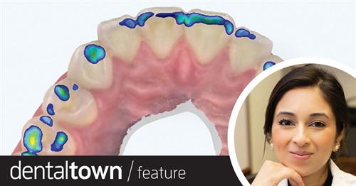 Show Your Work: Dental Restorations — Building Better Bonds  Dr. Hemali Ajmera recaps the options available for aesthetic dental restoration of malformed, misshapen or underdeveloped lateral incisors, and shares the step and details behind a same-day chairside treatment she performed for a patient who wanted a painless option to treat her short incisors.