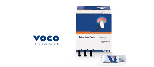 Product Profile: Voco Retraction Paste An essential element for precision impressions