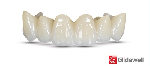 Industry Insights: Glidewell Prescribe restorations with confidence
