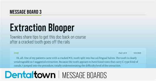 Extraction Blooper Townies share tips to get this doc back on course after a cracked tooth goes off the rails