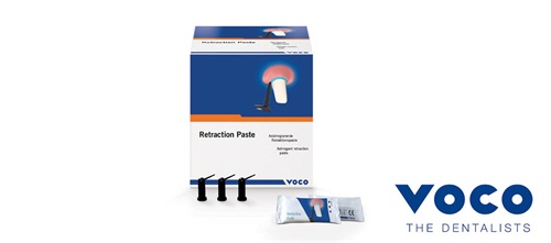 Product Profile: Voco Retraction Paste Unlocking optimal impression accuracy
