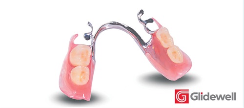 Product Profile: Glidewell Simply Natural Partials The SLM method: A better fit for partial dentures
