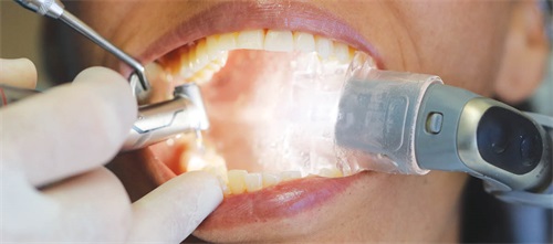 Why I Made the Switch: Zyris Isolite Pro Dr. Elaine Bylis shares why she started using Zyris Isolite Pro in her dental practice.