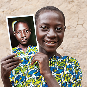 Operation Smile 