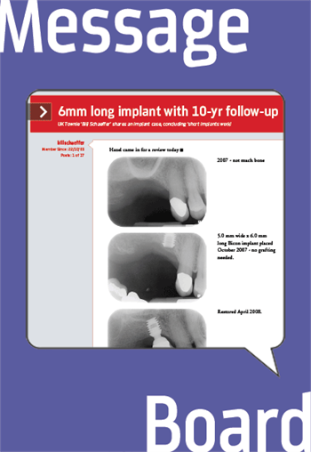 6mm long implant with 10-yr follow-up 