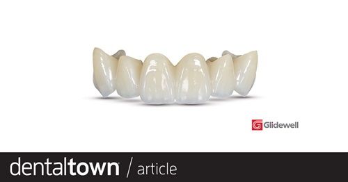 Product Profile: Glidewell BruxZir Lifetime Warranty