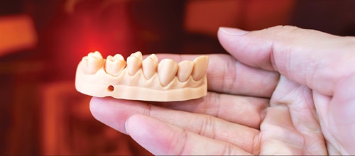 Fit to Print (Part 2) Interest in in-office aligner (IOA) systems is growing in the dental community, yet a limited number of providers have implemented this system in their practices. In the second part of his series, Dr. Rooz Khosravi breaks down parts of an IOA system and provides readers with essential information on how they can build one in their own practices.