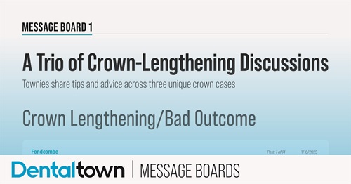 A Trio of Crown-Lengthening Discussions Townies share tips and advice across three unique crown cases