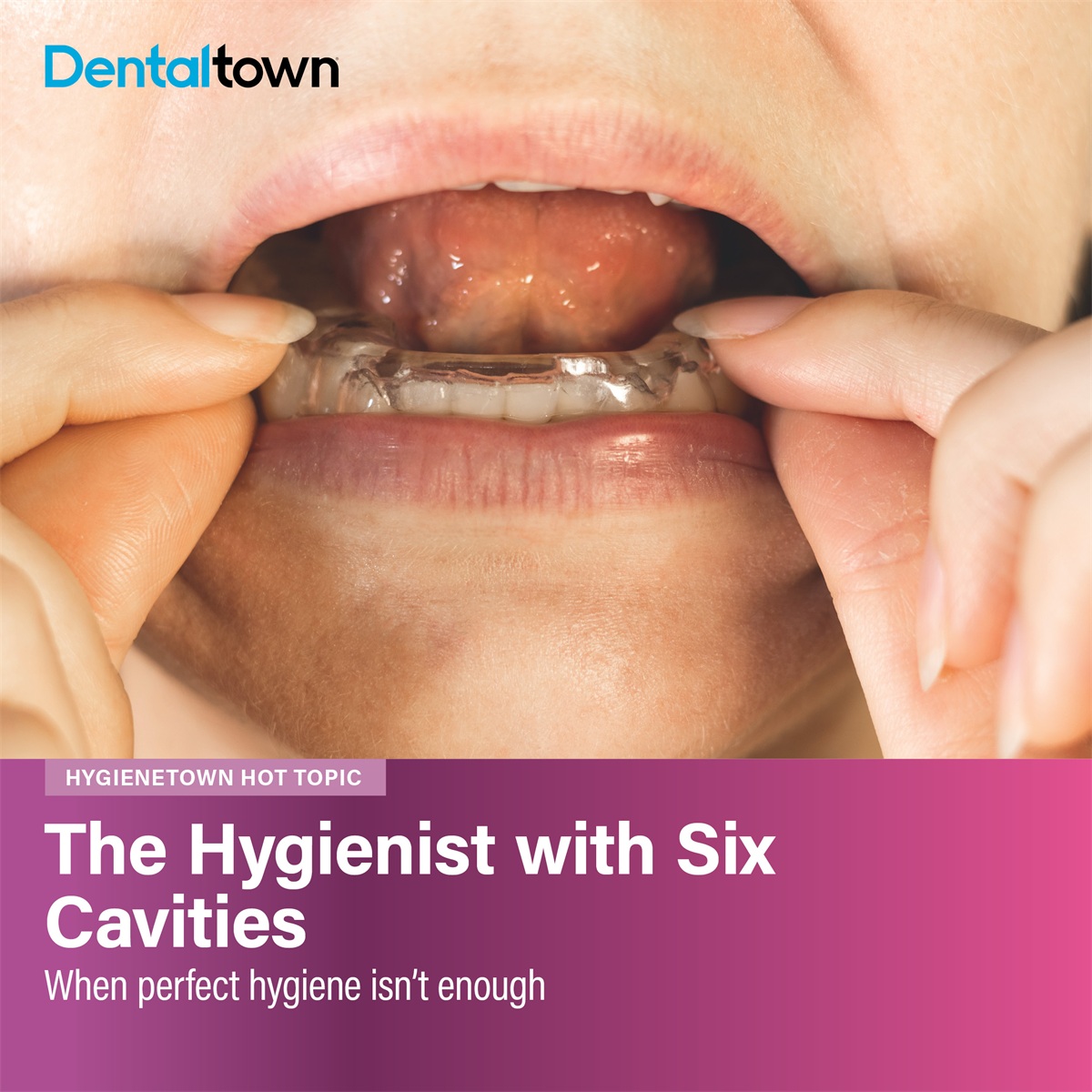 The Hygienist with Six Cavities
