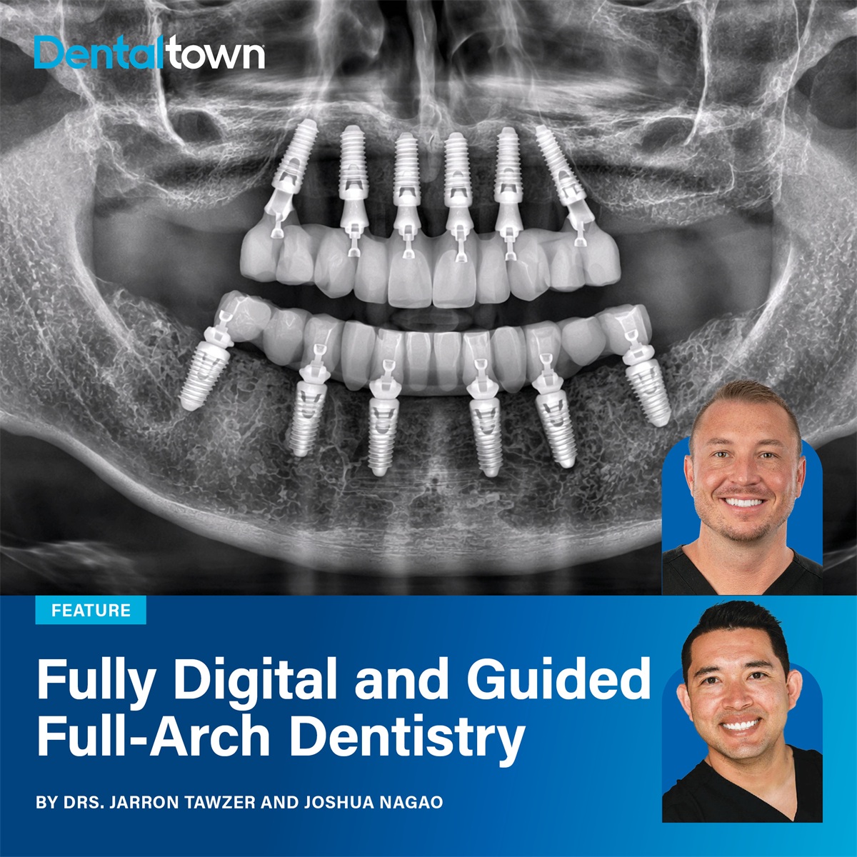 Fully Digital and Guided Full-Arch Dentistry