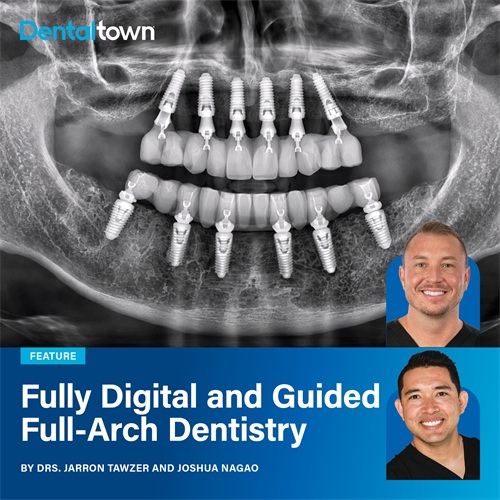 Fully Digital and Guided Full-Arch Dentistry Drs. Jarron Tawzer and Joshua Nagao walk through a complete digital full-arch implant case, showing how precise planning, guided surgery, and photogrammetry combine to produce predictable, reproducible results.
