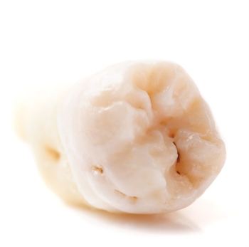 Caries Detection Technology A look at some of the top caries detection systems and software available in the industry