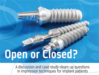 Open or Closed? Dr. Gary Radz discusses the indications for using open-tray or closed-tray impression techniques for implant cases.
