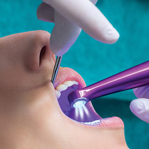 The  Best Cure Tips to make sure the curing light in your operatory is performing at the top of its game