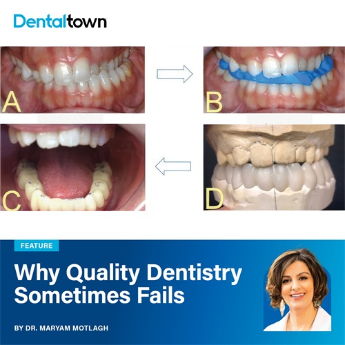 Why Quality Dentistry Sometimes Fails Dr. Maryam Motlagh explores how breathing, swallowing, and jaw function connect to treatment longevity and why a physiologic approach improves clinical outcomes.