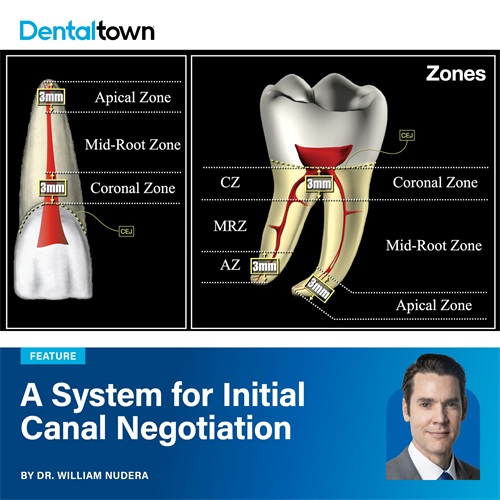 A System for Initial Canal Negotiation Dr. William Nudera presents a structured six-step framework for canal negotiation that transforms an intimidating procedure into a logical, predictable clinical workflow.