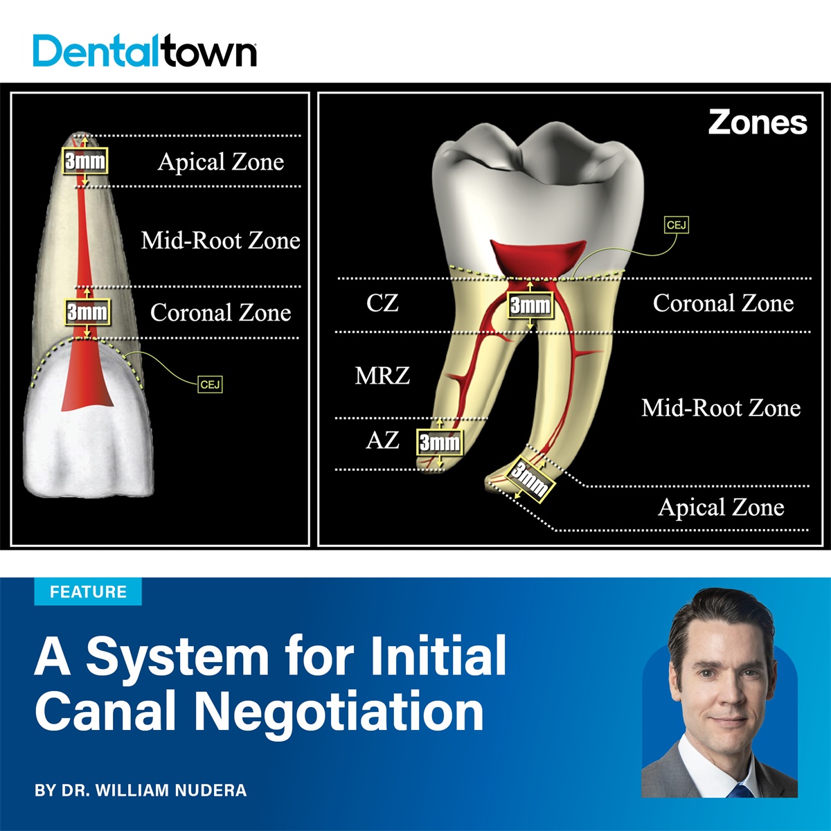 A System for Initial Canal Negotiation