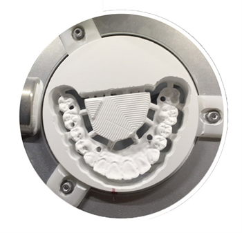 Practice Solutions: LSK121 Building a Beauty: Restoring a Grinding Patient's Beautiful Smile.