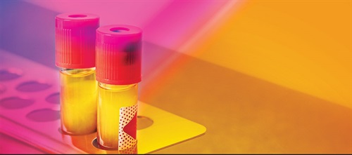 Utilizing Plasma-Rich Fibrin Drs. Jarron Tawzer and Joshua Nagao lay out four keys of platelet-rich fibrin treatments and how general dentists can easily fold this fascinating option into future implant and grafting cases.